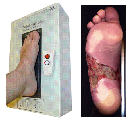 Patient’s Module and an exemplary wound documented using the module.